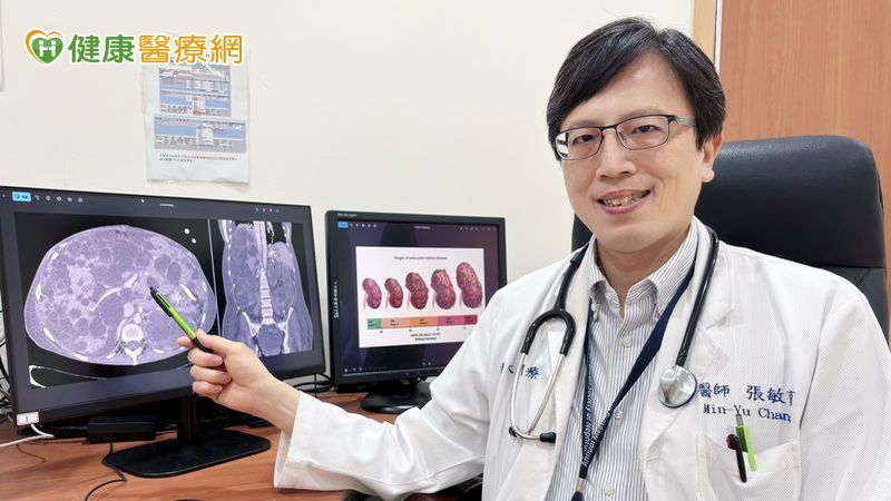 20歲無感10年後竟洗腎?新型口服藥阻多囊腎惡化