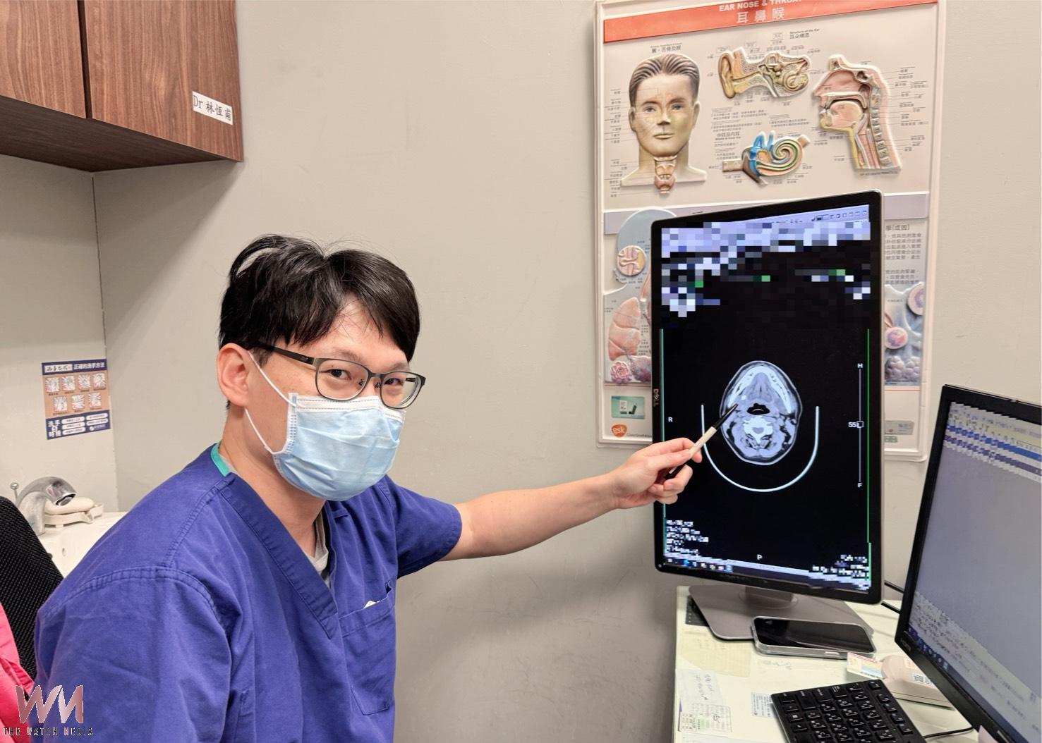 下巴腫竟是結石 微創精準取石不留疤 醫籲:多喝水 更要注意下半身這症狀 - https://www.watchmedia01.com