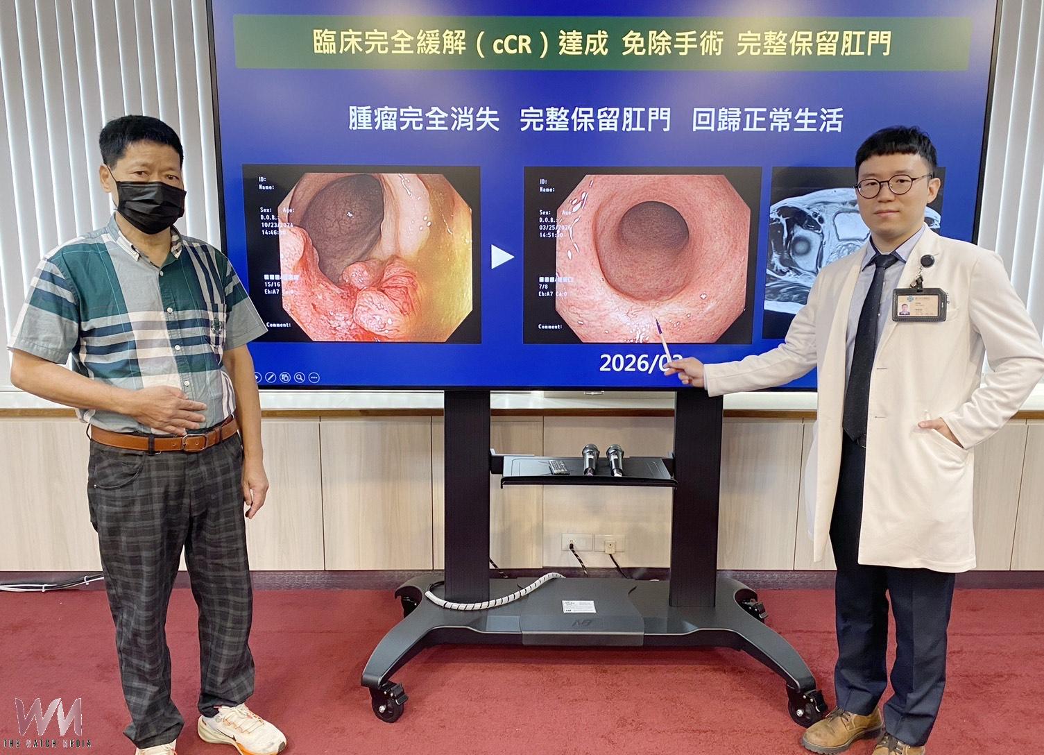 台中榮總精準TNT治療　助中低位直腸癌病人免開刀保肛 回歸生活日常