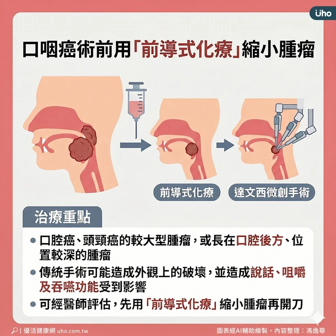前導式化療縮小腫瘤再手術