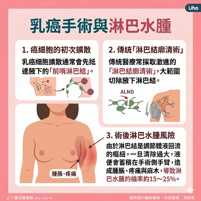 為什麼會產生淋巴水腫?