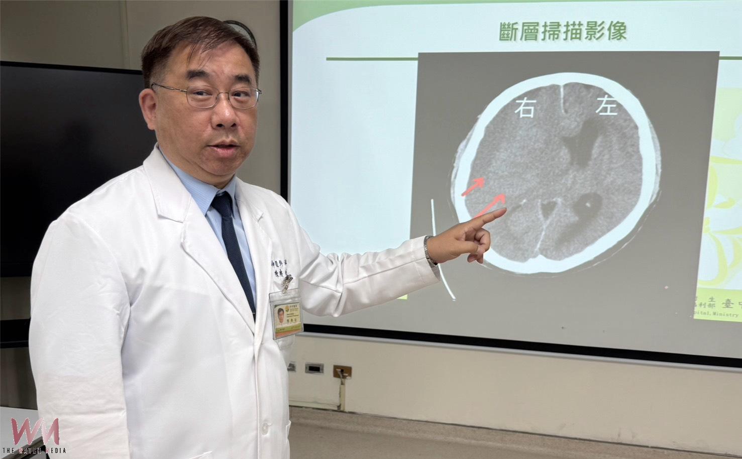 忙到半邊無力 攤商端午節前「亞急性腦出血」 醫籲3徵兆快就醫 - https://www.watchmedia01.com