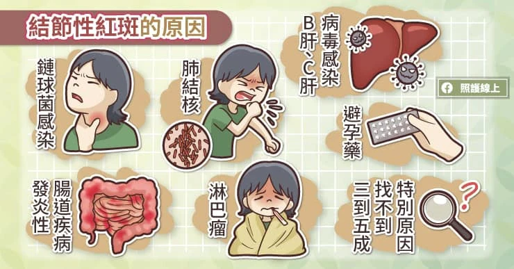 結節性紅斑的原因