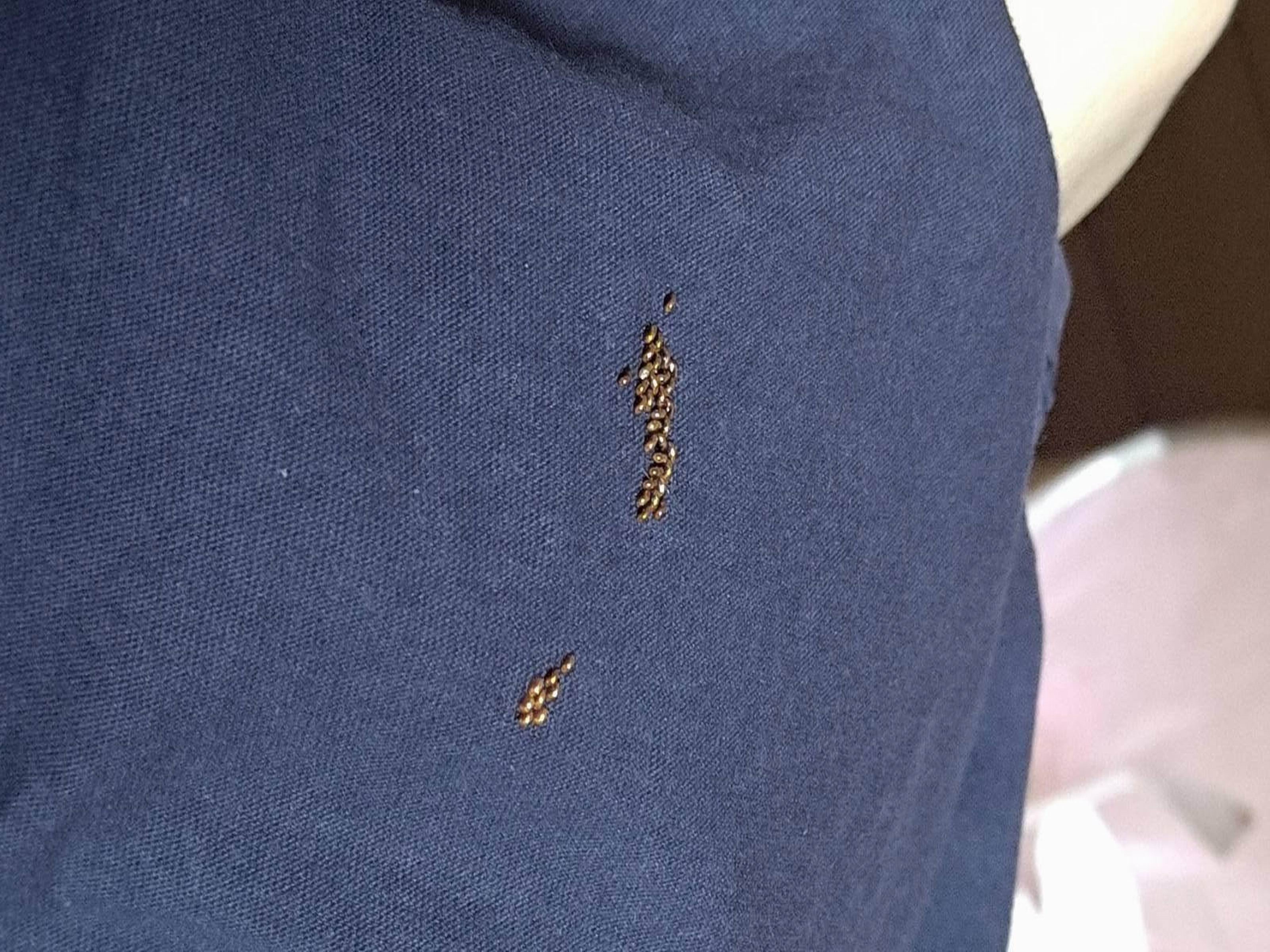 衣服上長滿「黃金蛋」！媽媽一看嚇到直接丟 - https://www.watchmedia01.com