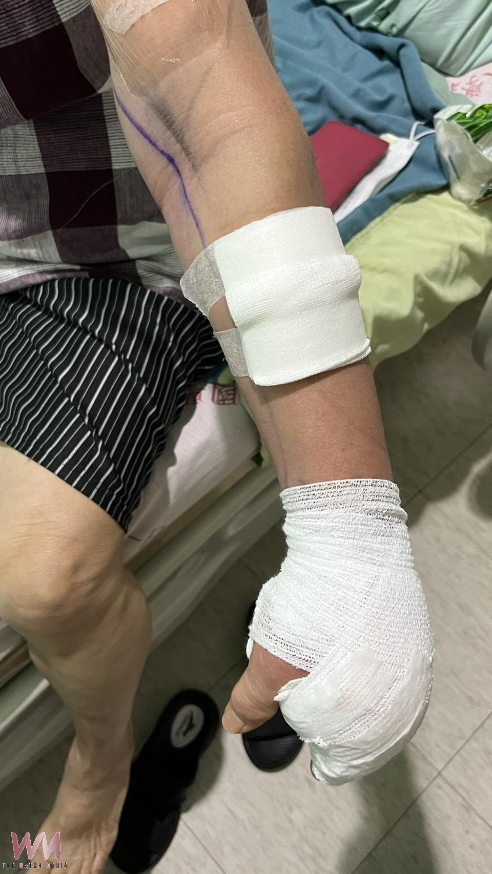 手碰吳郭魚竟釀嚴重感染險截肢　醫師示警北港類似案例已５起 - https://www.watchmedia01.com
