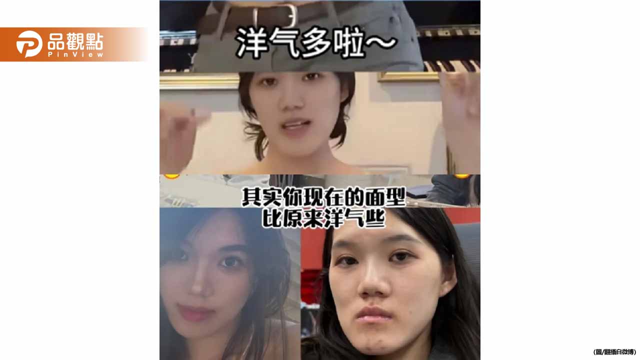 整容竟然變毀容！正妹術後「撞臉朱元璋」