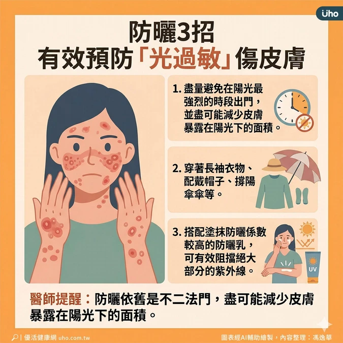 防曬3招有效預防光過敏