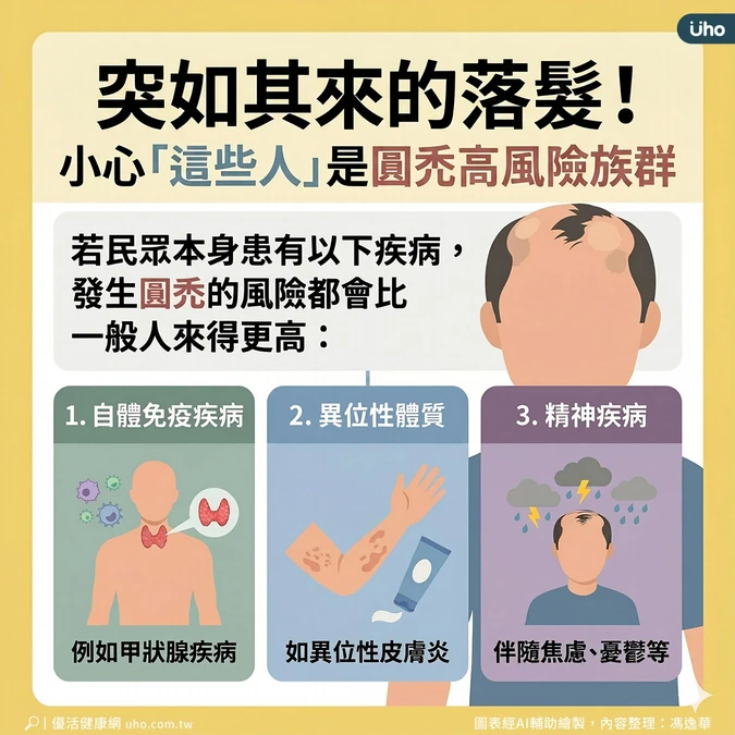 這些人是圓禿高風險族群
