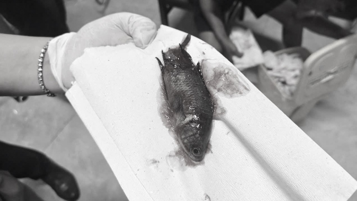 影／收網貪方便嘴含活魚　下秒「魚溜進喉嚨」卡食道！醫緊急夾出影片曝光