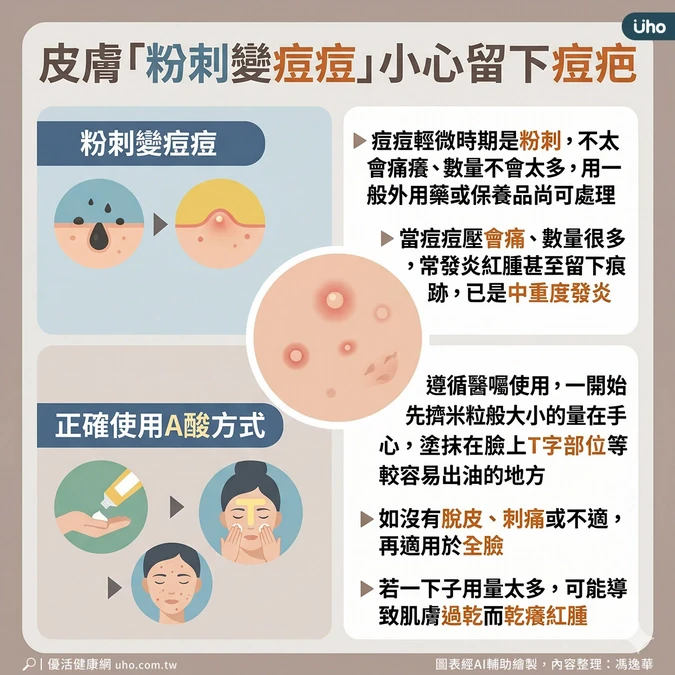 調查揭4成民眾擔心留痘疤
