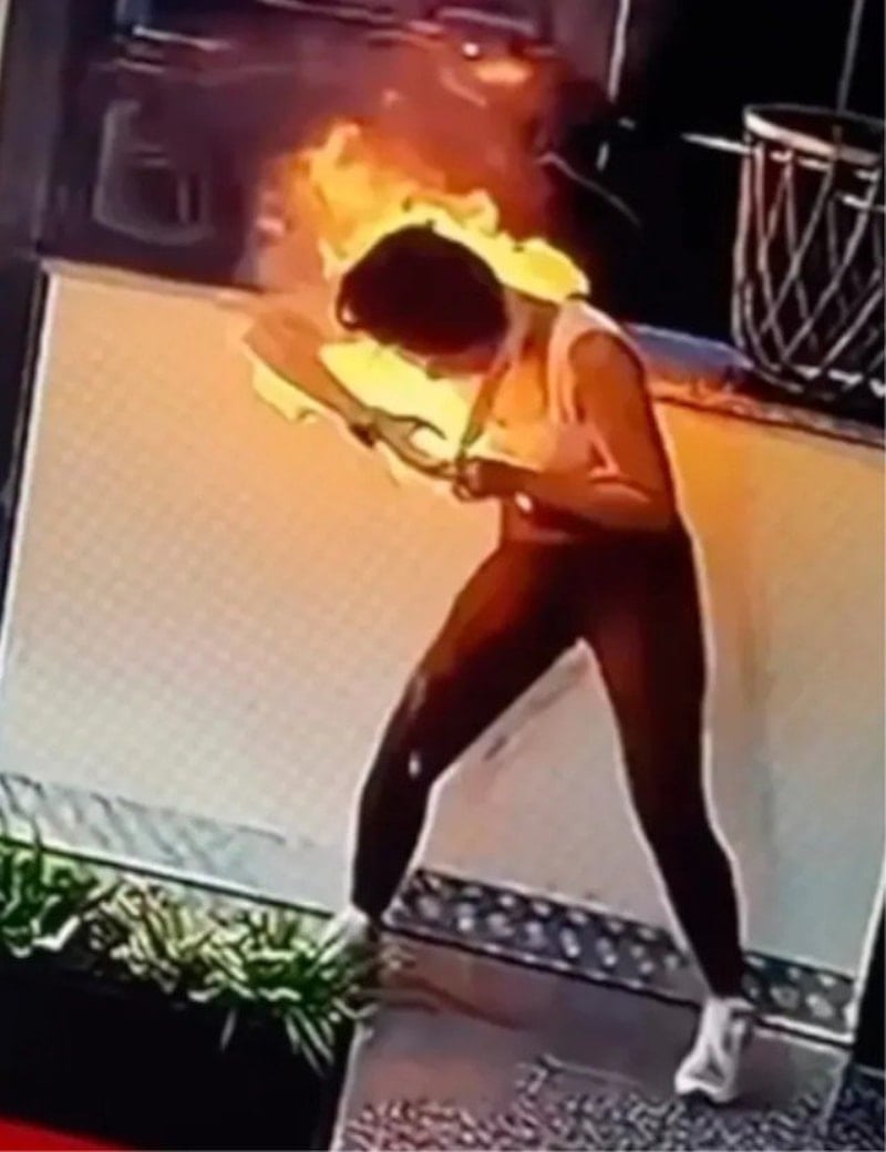 影/行動電源爆炸!哈薩克女突遭吞噬 全身變火球慘被燒傷