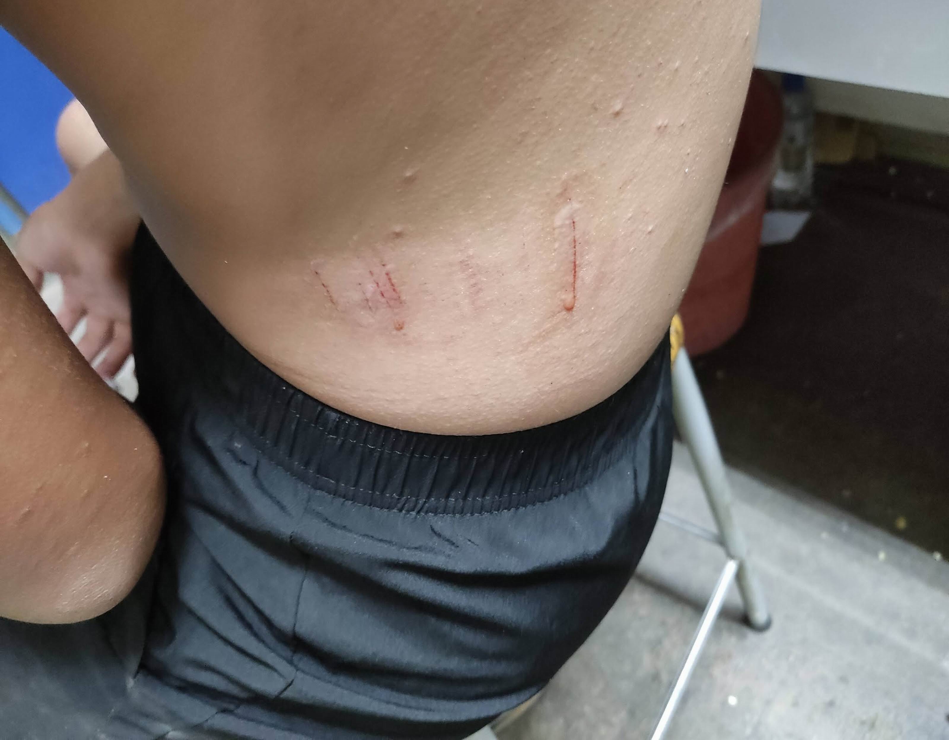 彰化市水尾二路驚傳狗群追人　男童傷痕累累逃回家 - https://www.watchmedia01.com