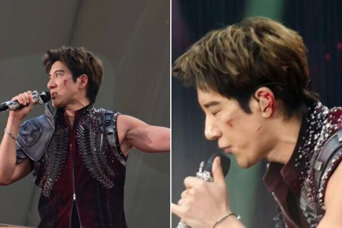 王力宏演唱會摔倒,左臉左耳鮮血直流。(圖/翻攝微博)