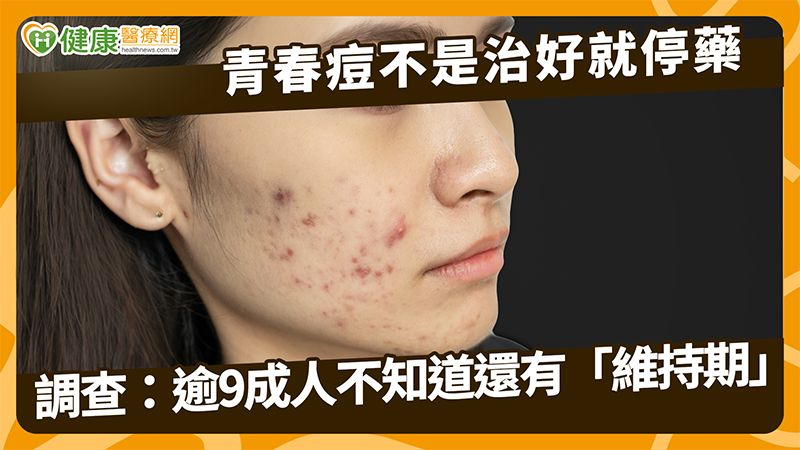 青春痘不是治好就停藥 調查:逾9成人不知道還有「維持期」