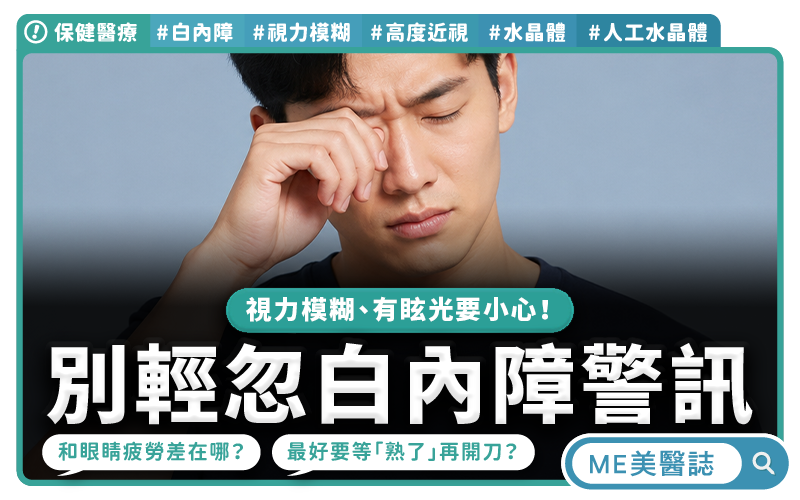 30、40歲也可能得白內障!高度近視族群注意,眼科醫師點名關鍵原因!–保健醫療|ME美醫誌
