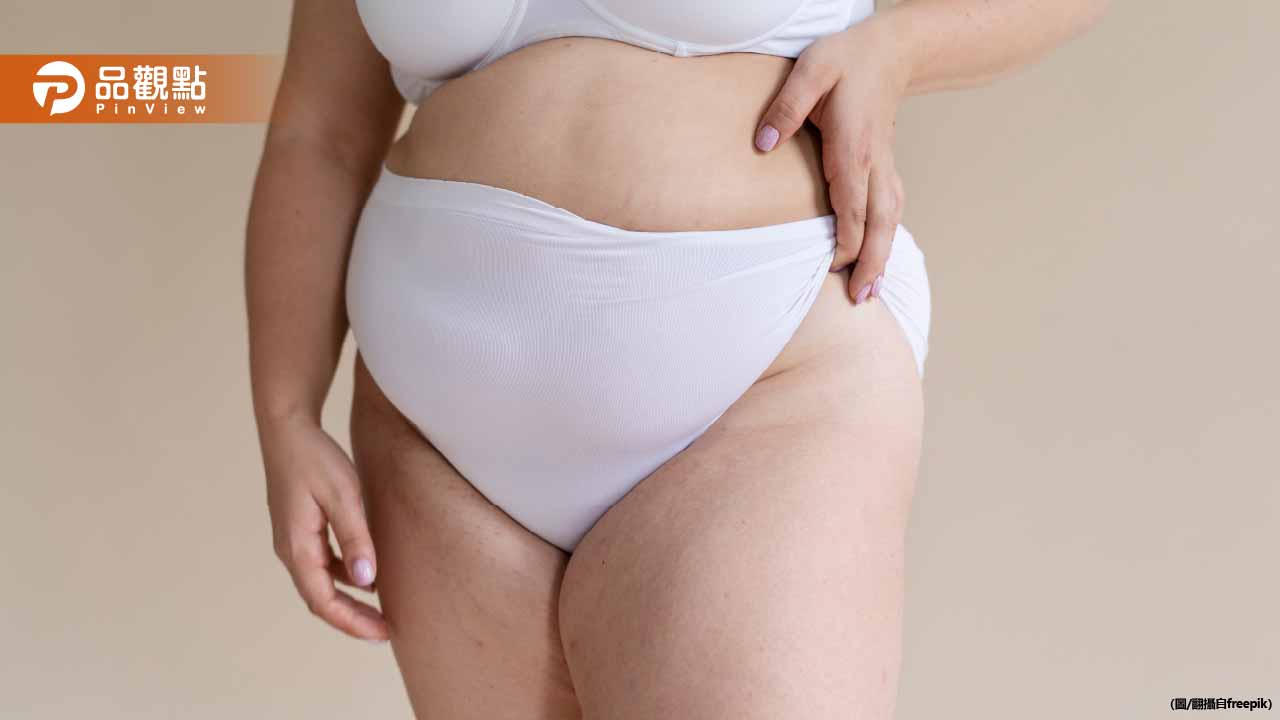 比內臟脂肪更危險!大腿長「雪花肌」恐是糖尿病前兆