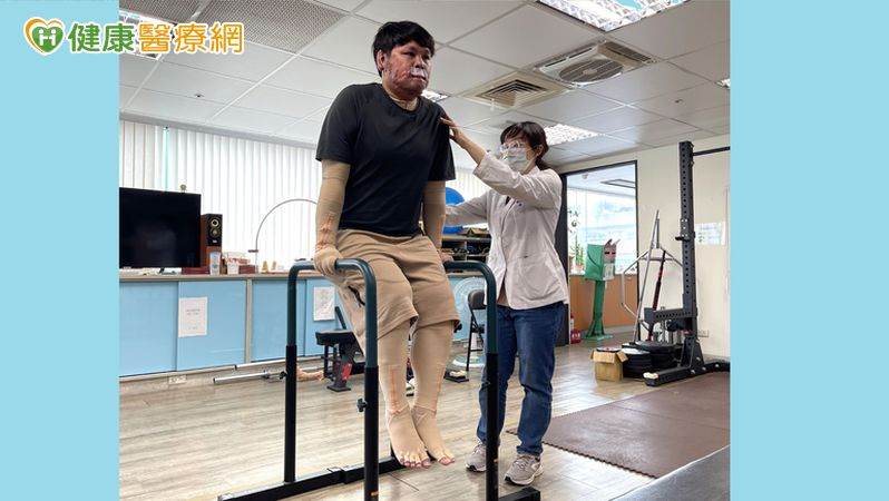 70%嚴重燒傷!30歲青年忍「皮膚撕裂」復健劇痛 半年重拾自主力