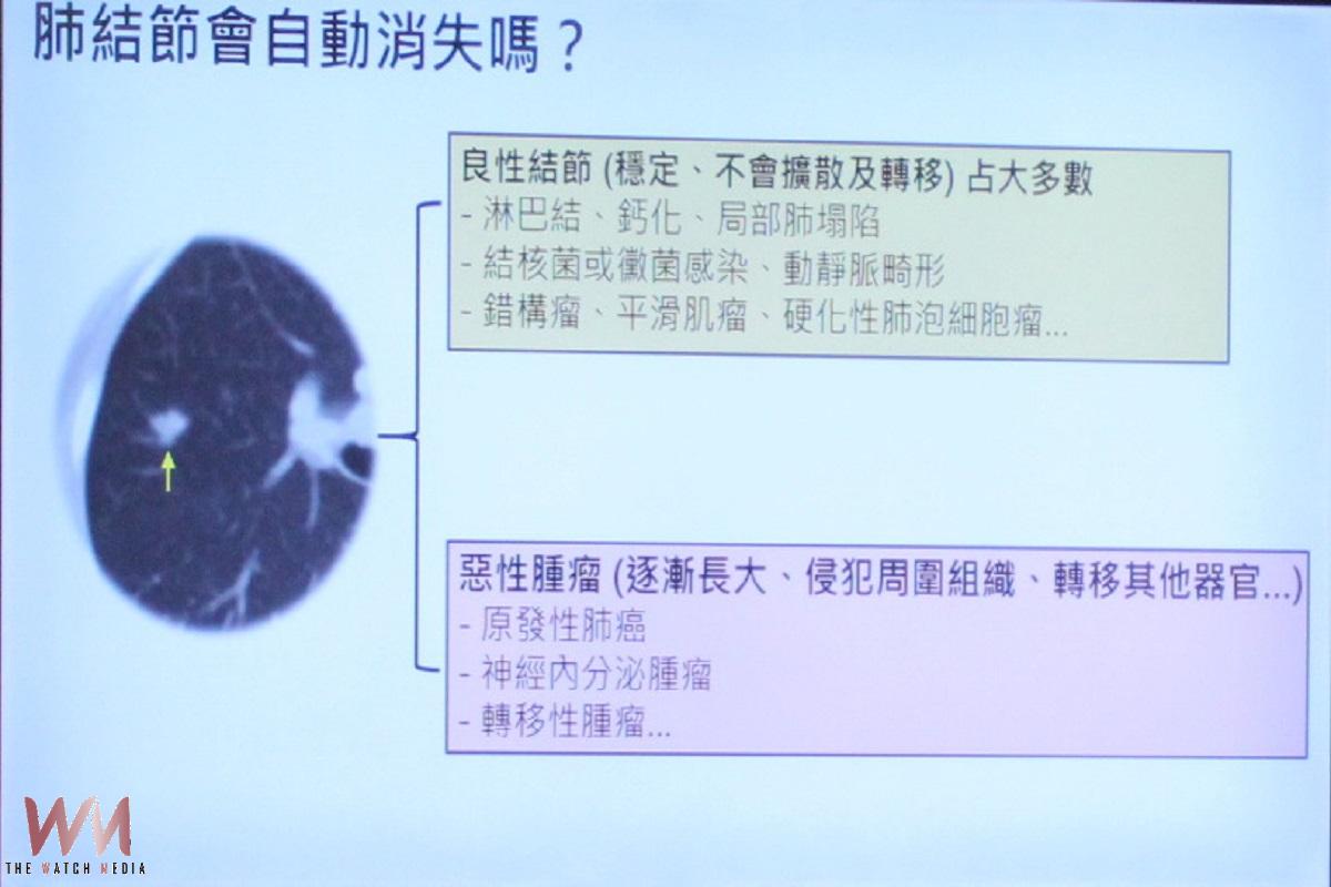 肺結節不等於肺癌莫恐慌    台大雲院精準診療劫後餘生 - https://www.watchmedia01.com