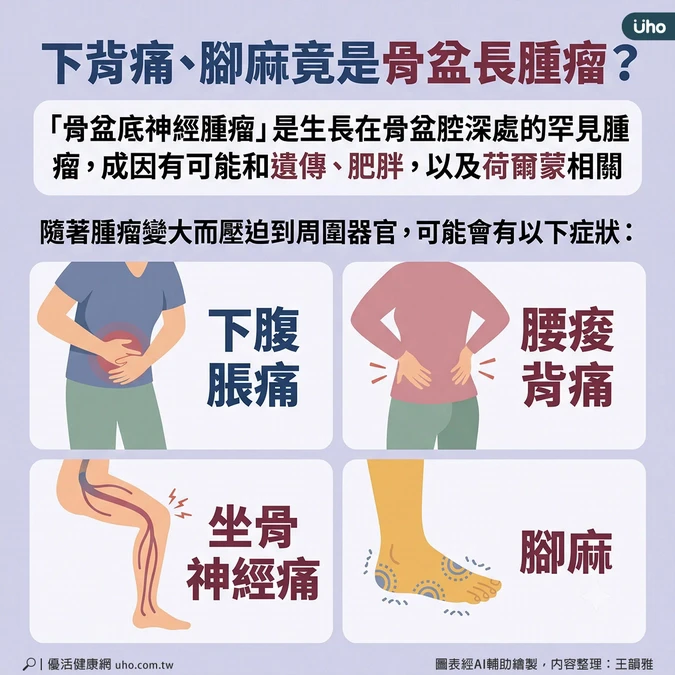 骨盆底神經腫瘤常見症狀