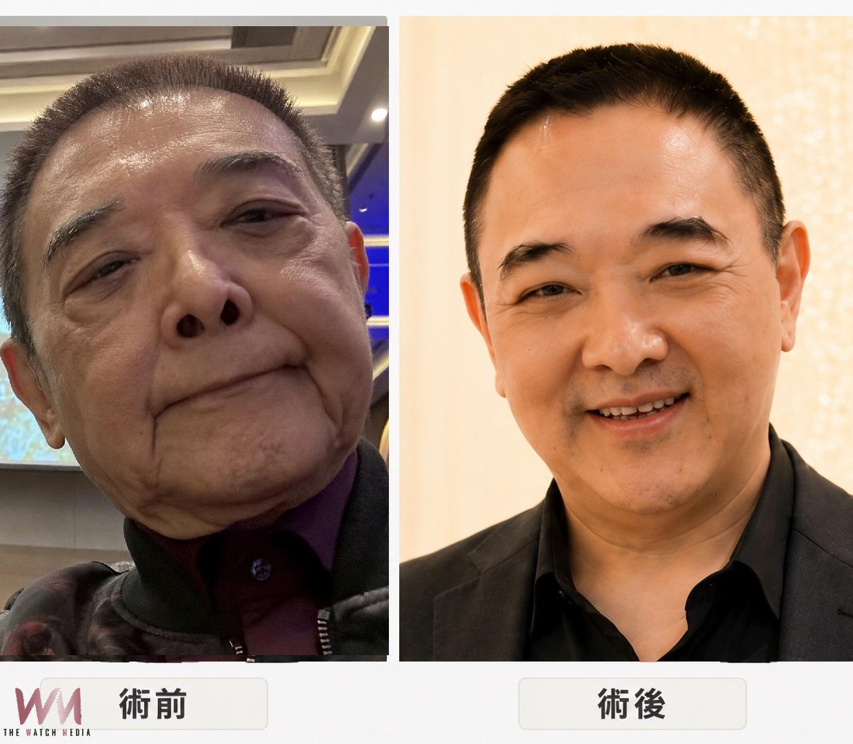 逼近70歲小亮哥凍齡回春驚艷眾人 愛照鏡子老婆笑稱臉比她還緊 - https://www.watchmedia01.com