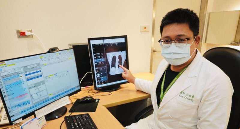 救心後再救肺!67歲婦歷經主動脈剝離 大同醫院3D/4K高階影像精準切除早期肺癌