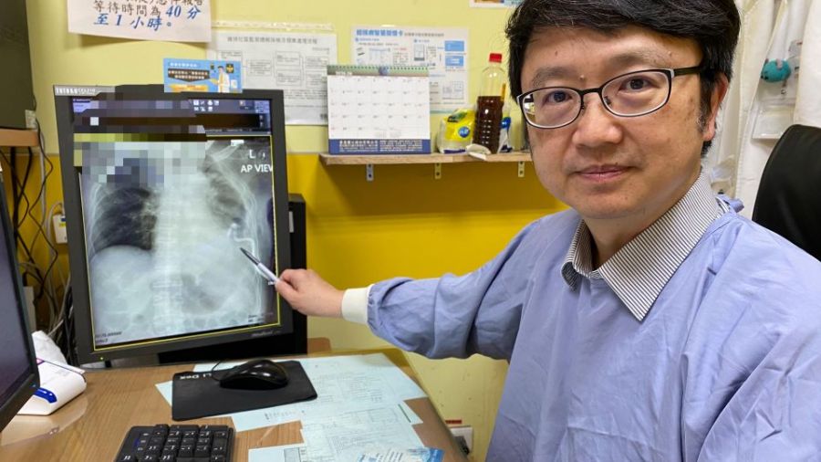 中風男肺炎惡化成膿胸　員榮以微創引流搶回一命