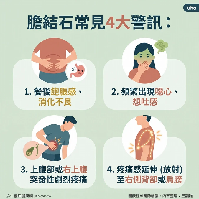 膽結石常見4大警訊