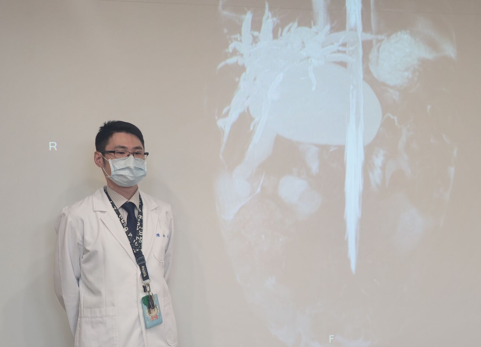 家長留意!1歲童腹脹嘔吐3天 罕見「先天性膽管囊腫」增癌風險 256 家長留意!1歲童腹脹嘔吐3天 罕見「先天性膽管囊腫」增癌風險 255