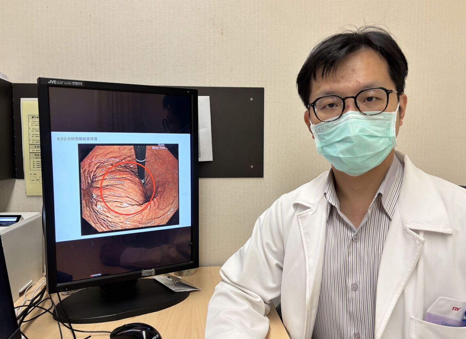 熟男「一種悶脹的感覺」半年不退 一照胃鏡竟6cm惡性腫瘤 194 熟男「一種悶脹的感覺」半年不退 一照胃鏡竟6cm惡性腫瘤 193