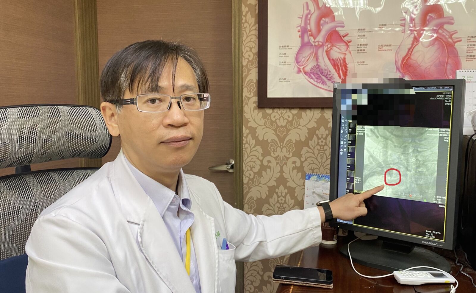 他洗腎手腫、臉腫異變 少見中心靜脈完全阻塞！醫頸部打通血管 209
