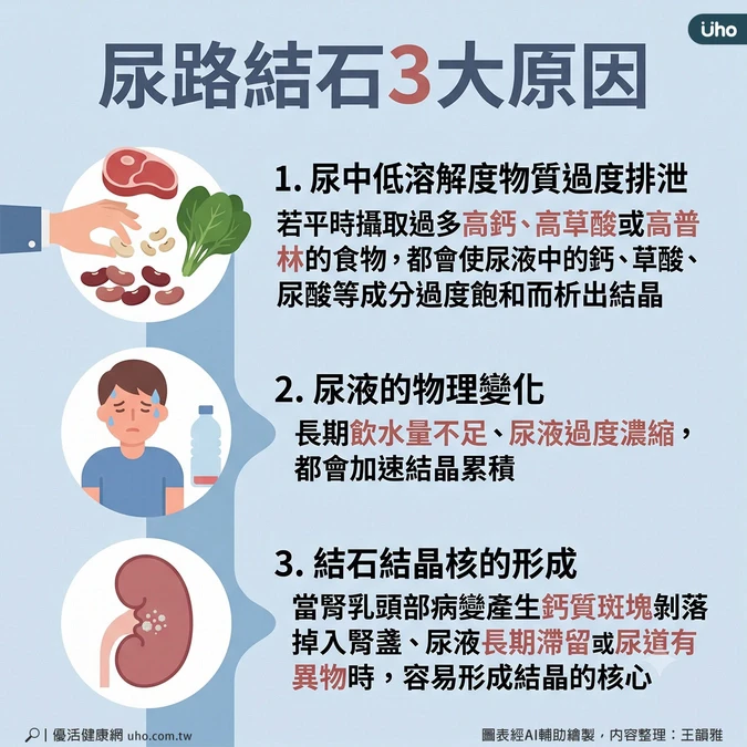 尿路結石3大原因