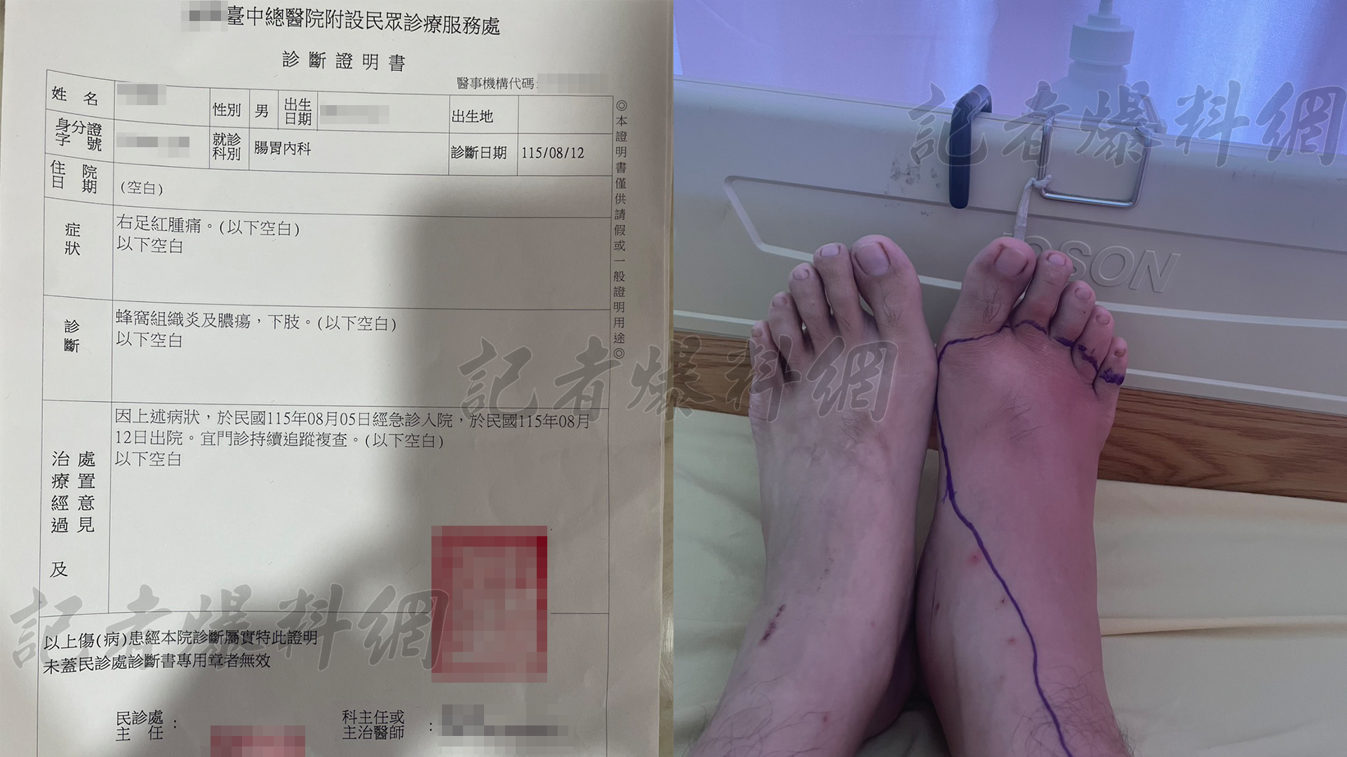 ▲成功嶺替代役再爆醜聞!役男就醫遭幹部放生,延誤治療釀「蜂窩性組織炎」險截肢(圖/記者王俊勝 翻攝)