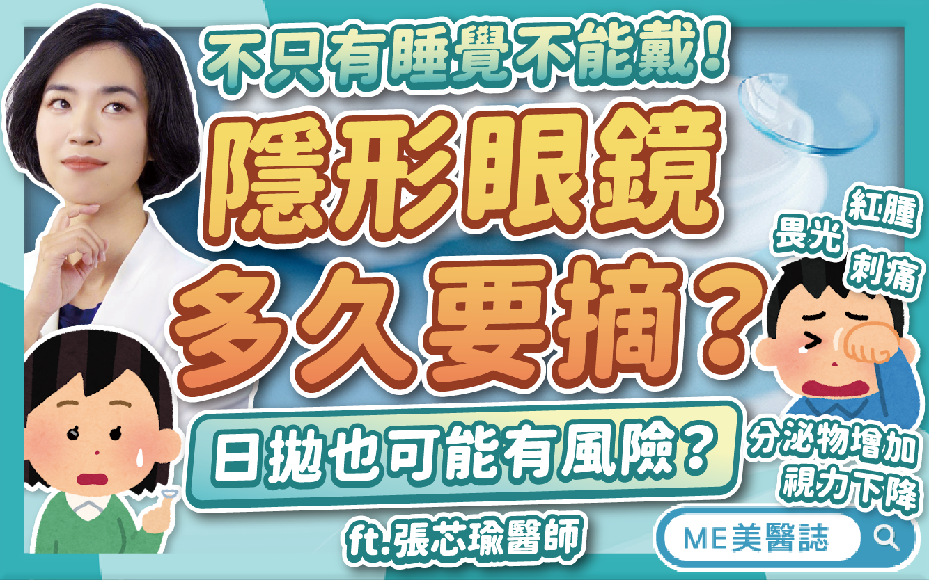 隱形眼鏡「多戴久一點」不會怎麼樣?不只戴著睡覺,這些壞習慣都不行–名醫問診室|ME美醫誌