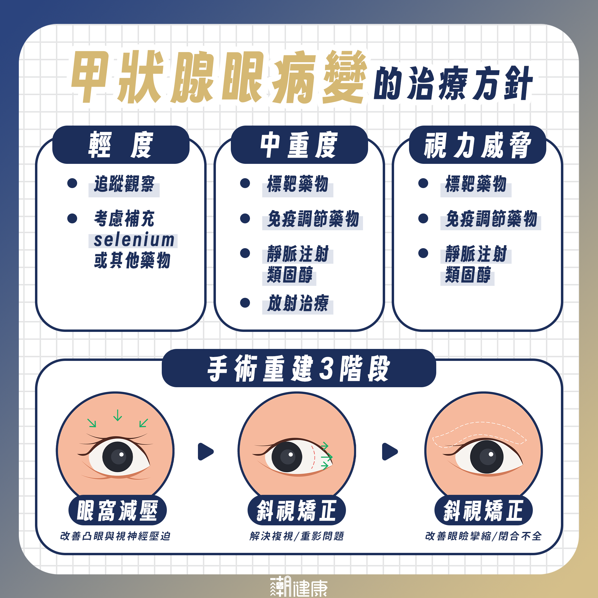 甲狀腺功能正常也可能罹病? 專家示警:「凸眼、視野重疊」恐是甲狀腺眼病變 內文圖片 2