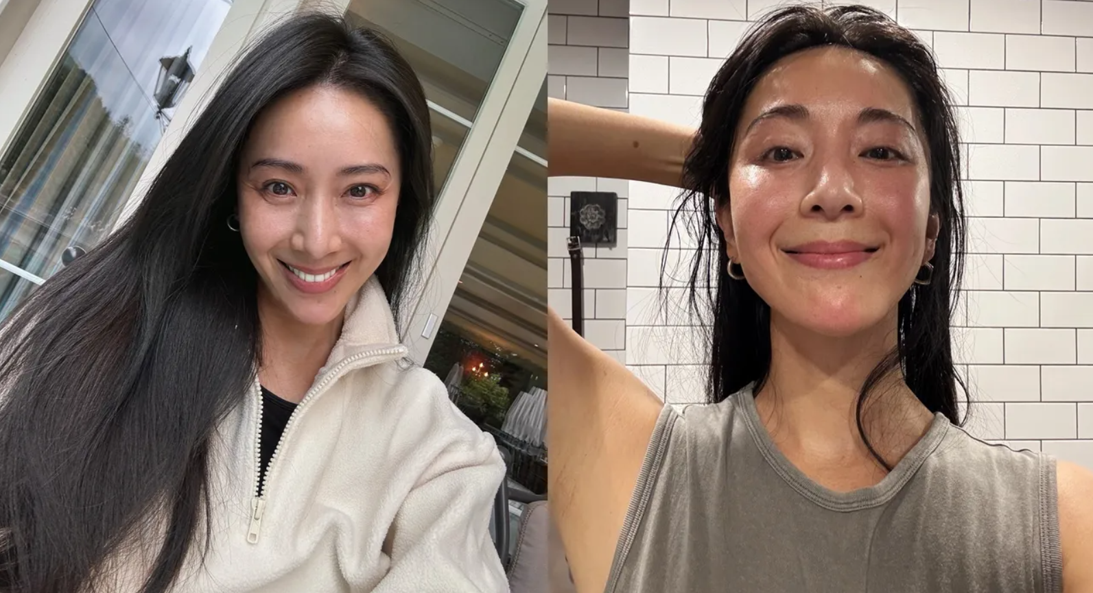 隋棠大方PO出醫美術後的照片。(圖/翻攝隋棠IG)