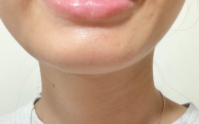 女網友牙齒貼這東西出門 老爸皺眉:怎麼卡那麼大一片菜? 女網友牙齒貼這東西出門 老爸皺眉:怎麼卡那麼大一片菜?